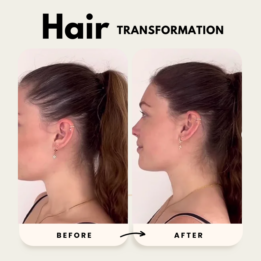 Lustrao Hair Growth Duo| Consistency Kit-2