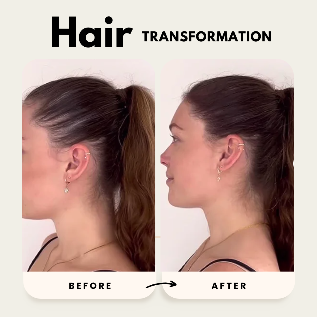 Lustrao Hair Growth Duo| Consistency Kit-2