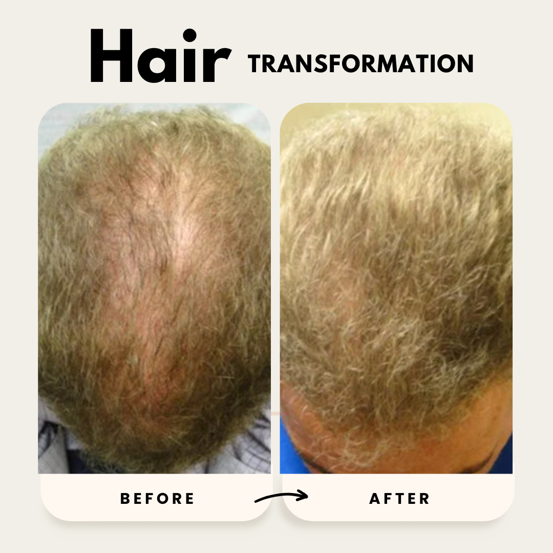 Lustrao Hair Growth Duo| Consistency Kit-3